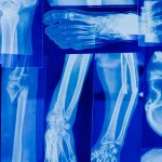 radiographs